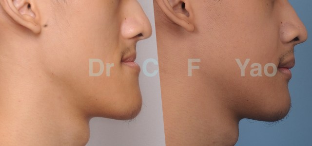 class III profile photo 02 .001