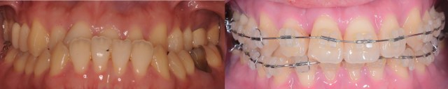 IntraOral01.001