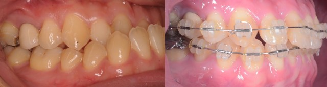 IntraOral02.001