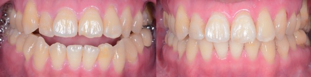 IntraOral 01--Final.001