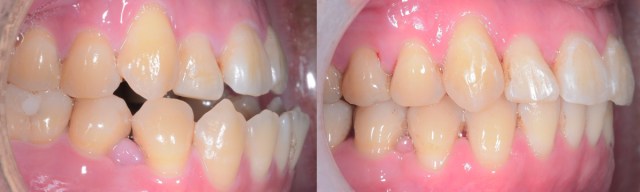 IntraOral 03-Final.001